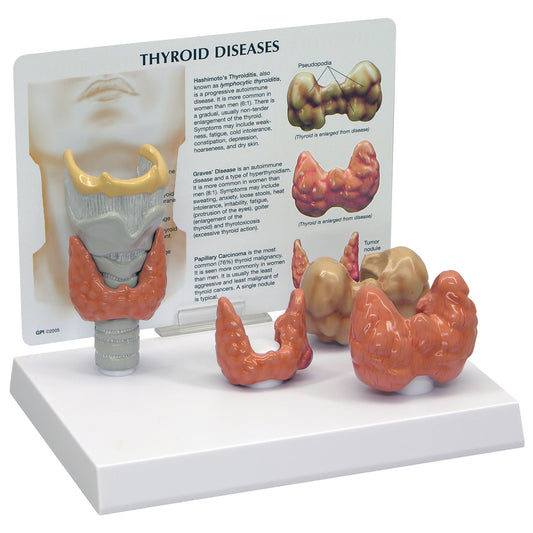 Thyroid Gland Anatomy Model