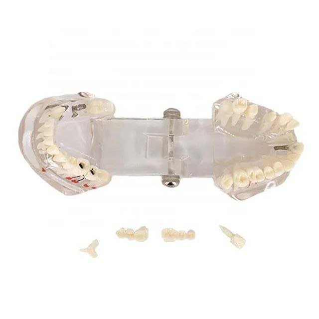 Dental Anatomy Model - drtobe