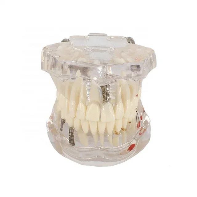 Dental Anatomy Model - drtobe
