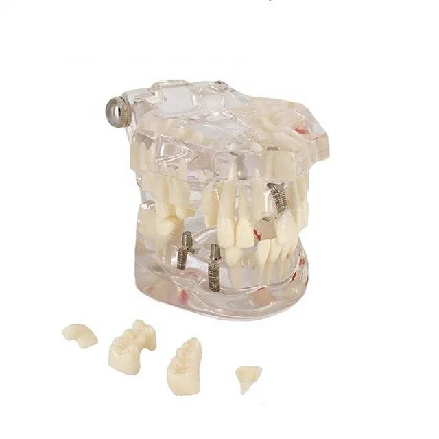 Dental Anatomy Model - drtobe