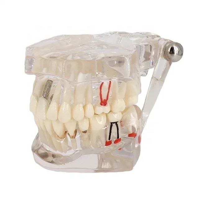 Dental Anatomy Model - drtobe