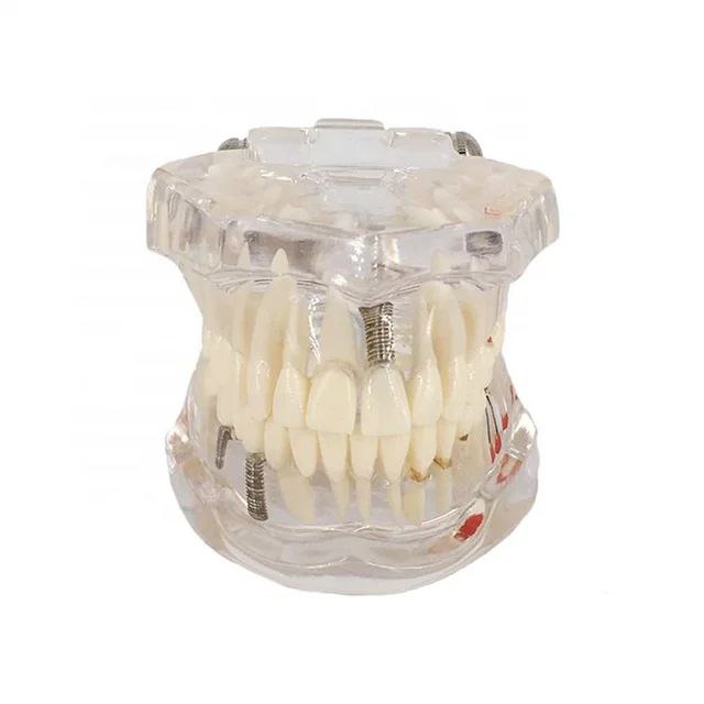 Dental Anatomy Model