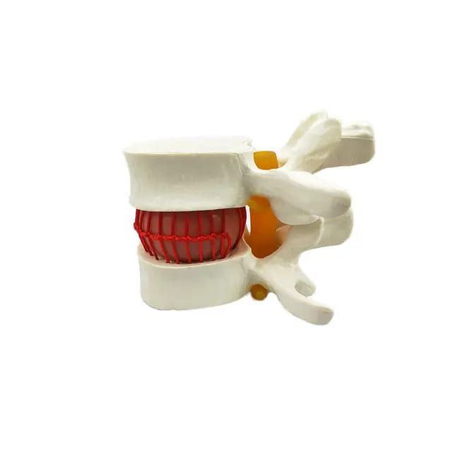 Disc Anatomy Model - drtobe