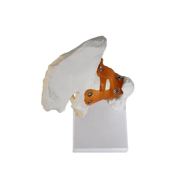 Hip Anatomy Model - drtobe