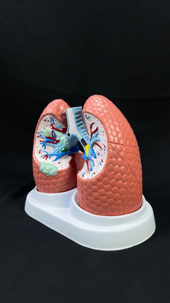Lungs Anatomy models - drtobe