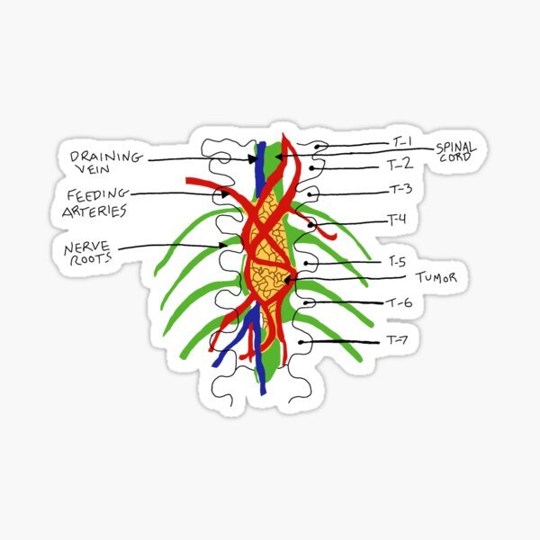 Tumor on Wall Grey's Anatomy Sticker - drtobe